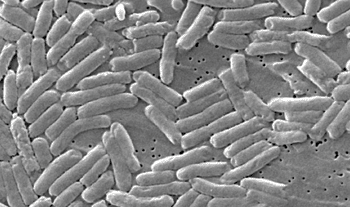 Image: Scanning electron micrograph of Salmonella bacteria (Photo courtesy of US Centers for Disease Control).